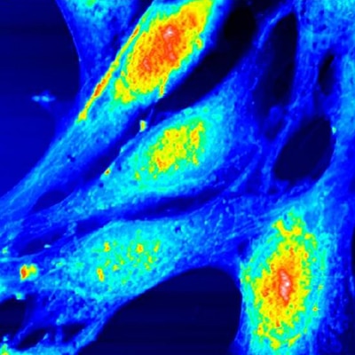 embryonic fibroblast cells oscillating mode 80µm